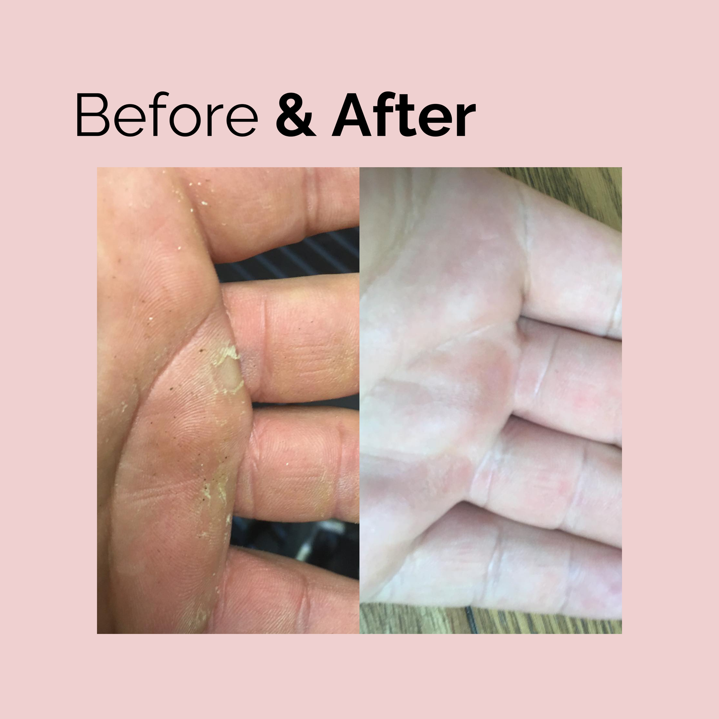 Hand Balm